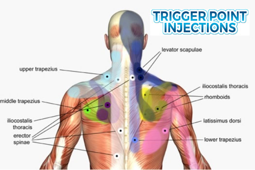 suffolk county trigger point injections